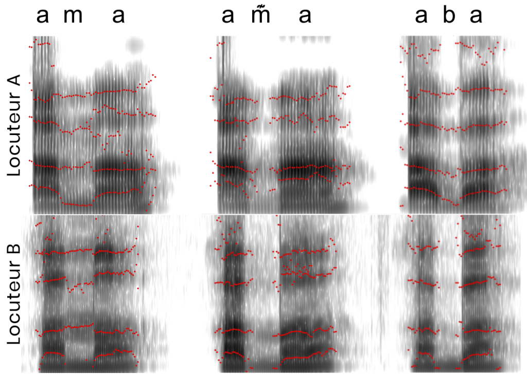 Spectrogramme de sons prononcés avez un nez bouché en comparaison de sons normaux